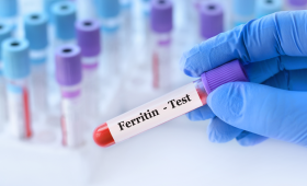 Картинка - Дефицит железа без анемии: признаки и лабораторная диагностика