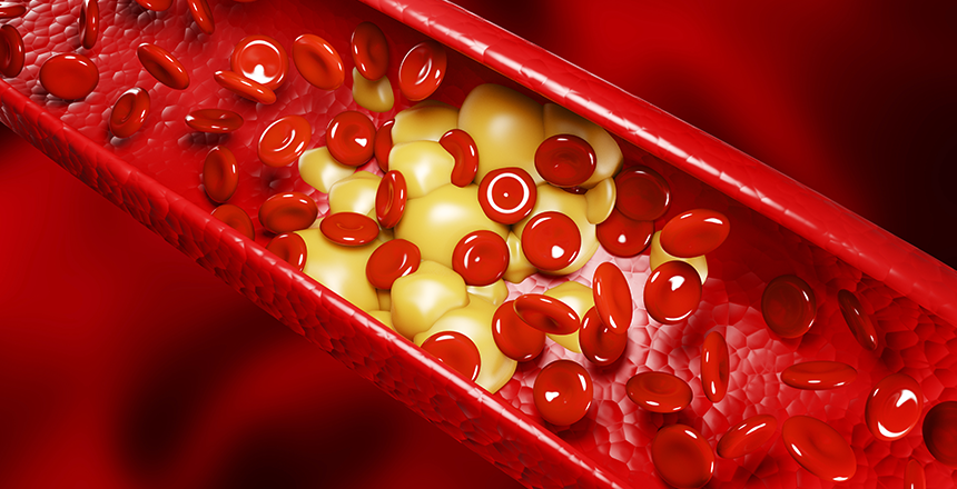 Фото - Холестерин: чем грозит, как контролировать и когда нужно пройти исследование