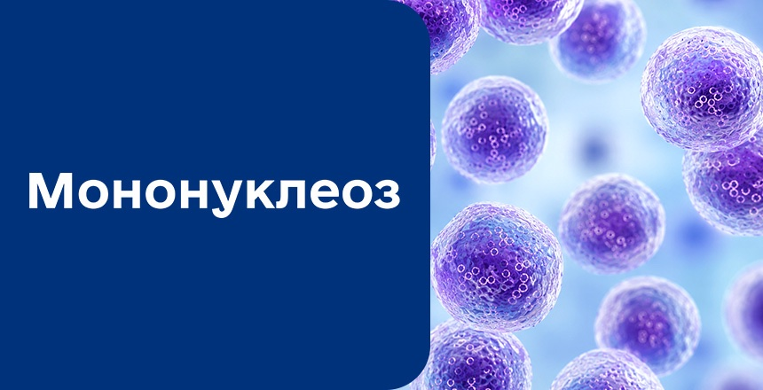 Фото - Мононуклеоз: збудник, симптоми та ускладнення