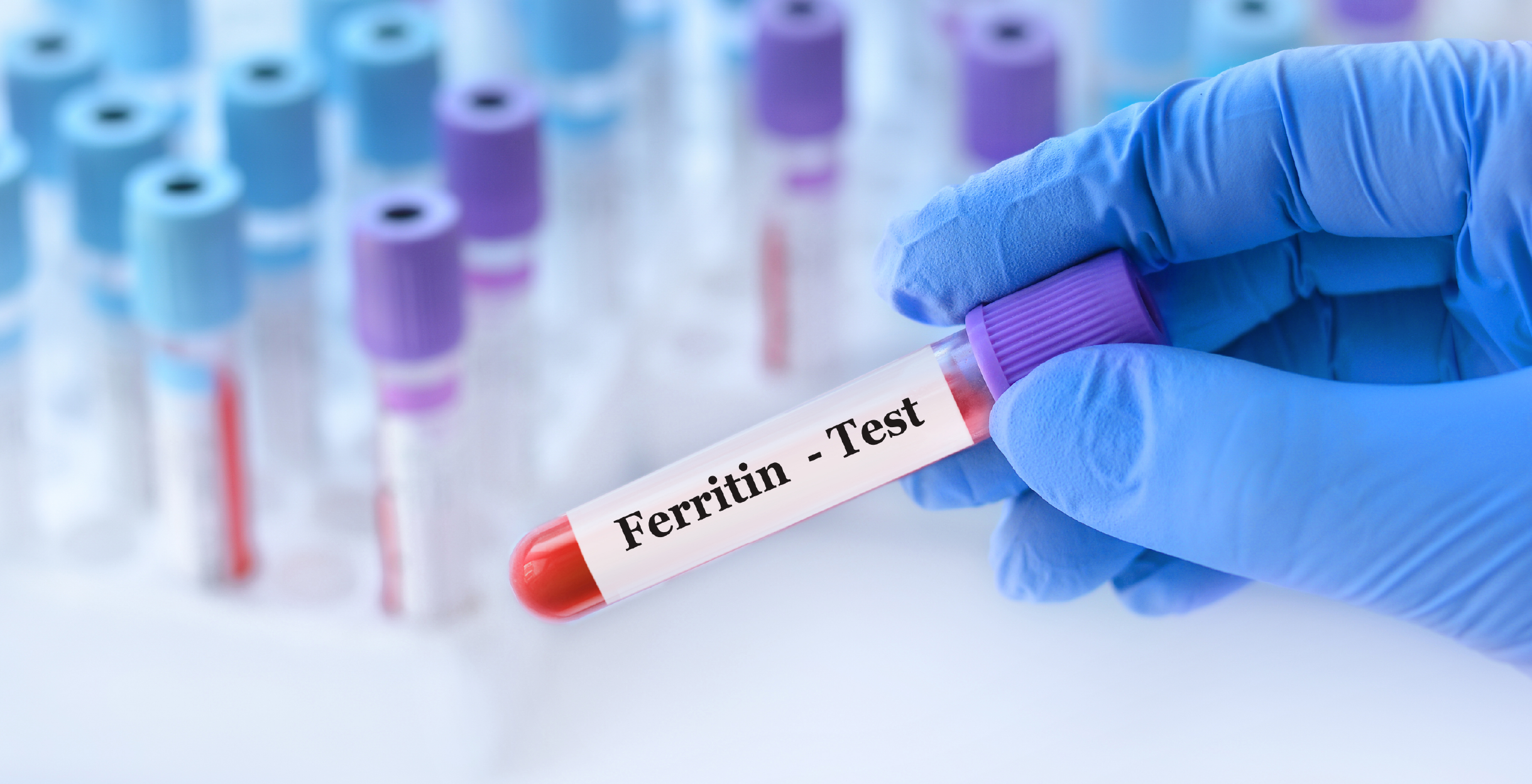 Фото - Дефицит железа без анемии: признаки и лабораторная диагностика