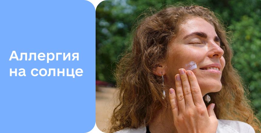 Фото - Солнечная аллергия (фотодерматоз) у взрослых и детей