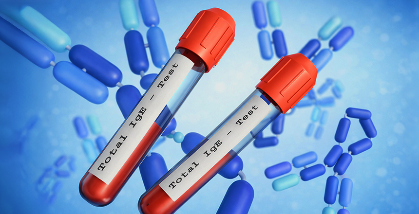 Фото - ALEX³: НОВИЙ РІВЕНЬ МОЛЕКУЛЯРНОЇ АЛЕРГОДІАГНОСТИКИ В ДІЛА