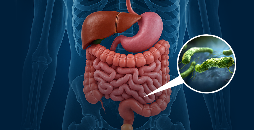 Фото - Лечение и диагностика инфекции Helicobacter pylori у пациентов с ишемической болезнью сердца