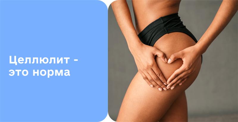 Фото - Целлюлит: виды, симптомы и как избавиться