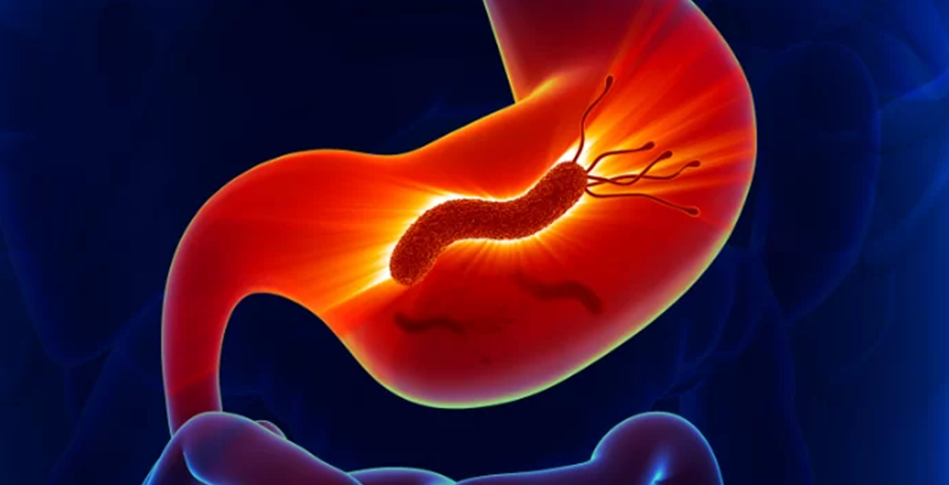 Фото - Клінічний випадок: роль лабораторних досліджень у діагностиці Helicobacter pylori-асоційованого гастриту