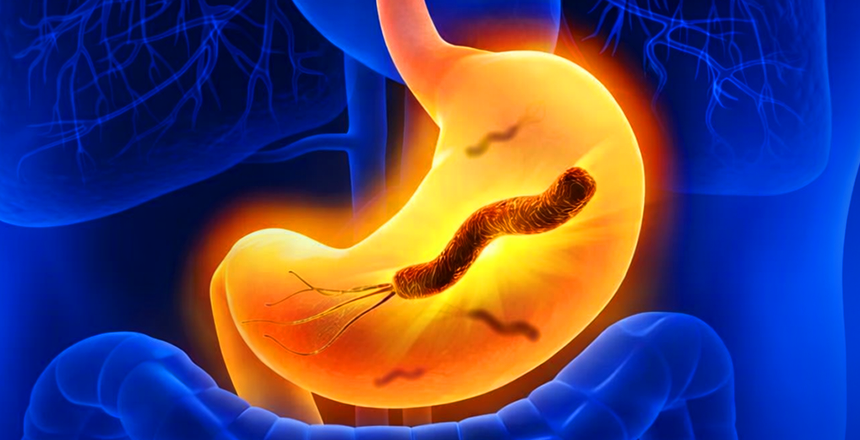 Фото - Сучасна діагностика інфекції Helicobacter pylori: можливості МЛ ДІЛА на всіх етапах ведення пацієнта